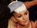 DOI: Jennifer Ellison injures herself while performing a 'Scorpian Kick' during her routine 