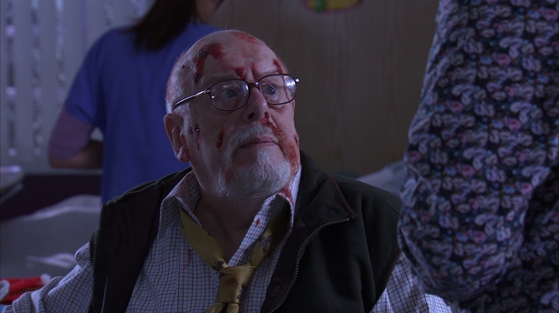 John Savident in Holby City