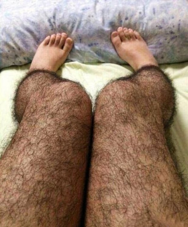 'Anti-pervert hair stockings' popular in China