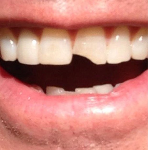 Jim Carrey shows off Lloyd Christmas teeth for 'Dumb and Dumber To'